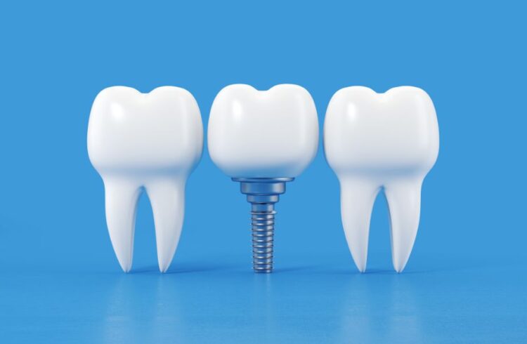 Zobna protetika cenik