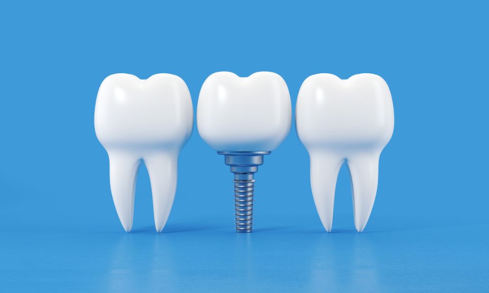 Zobna protetika cenik